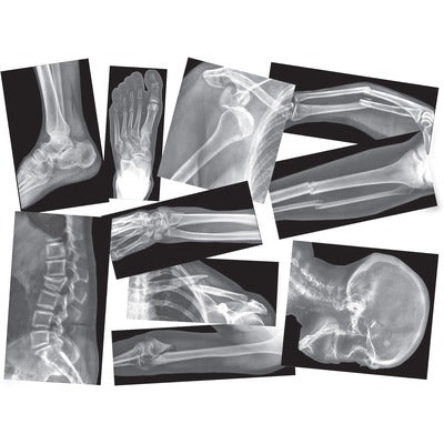 xray set for kids
